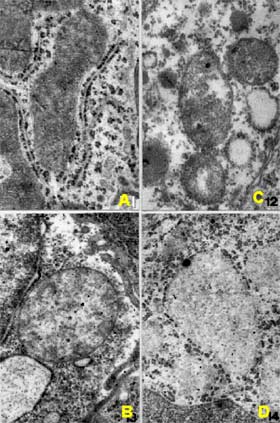 mitochondrie irradiée