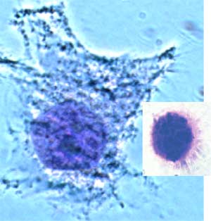 cellule en nécrose
