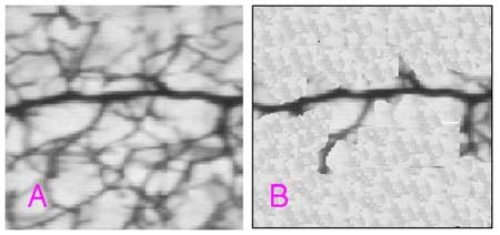 occlusion d'artere