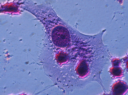 macrophage